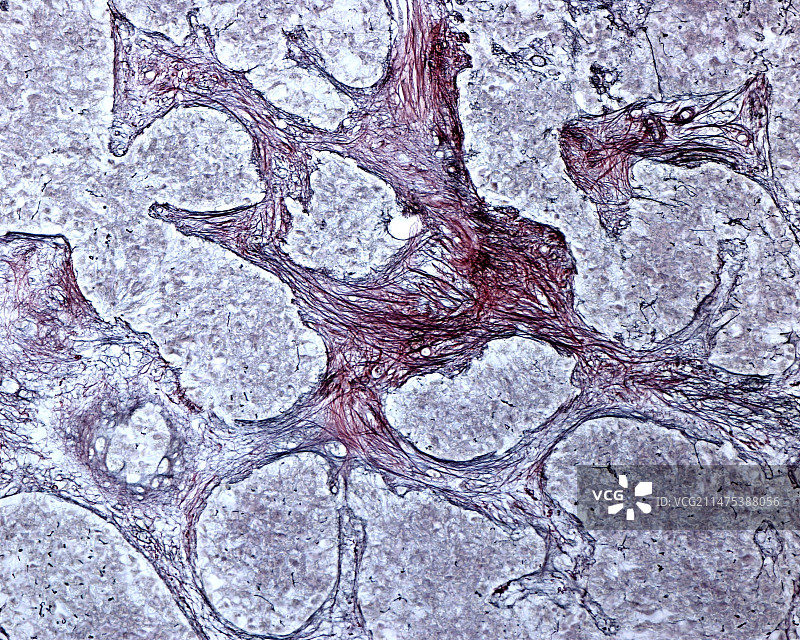 松果体网状纤维光学显微照片图片素材