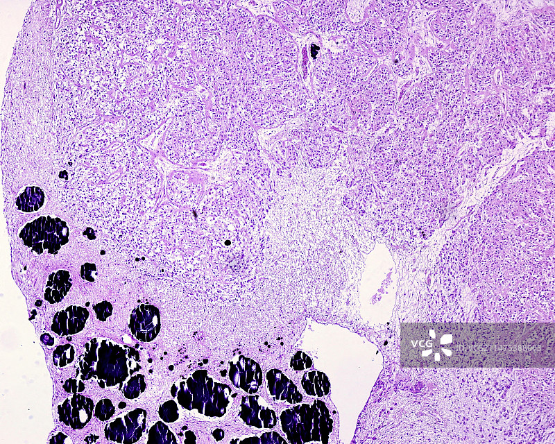 缰联合，光学显微照片图片素材
