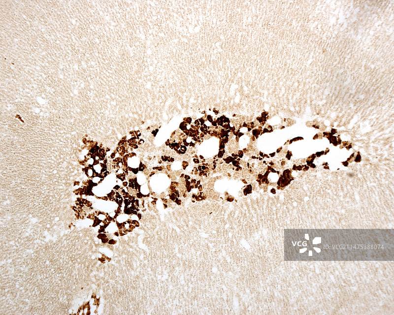 肾上腺髓质显微照片图片素材