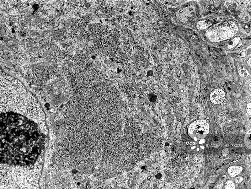 交感神经元，透射电镜图片素材
