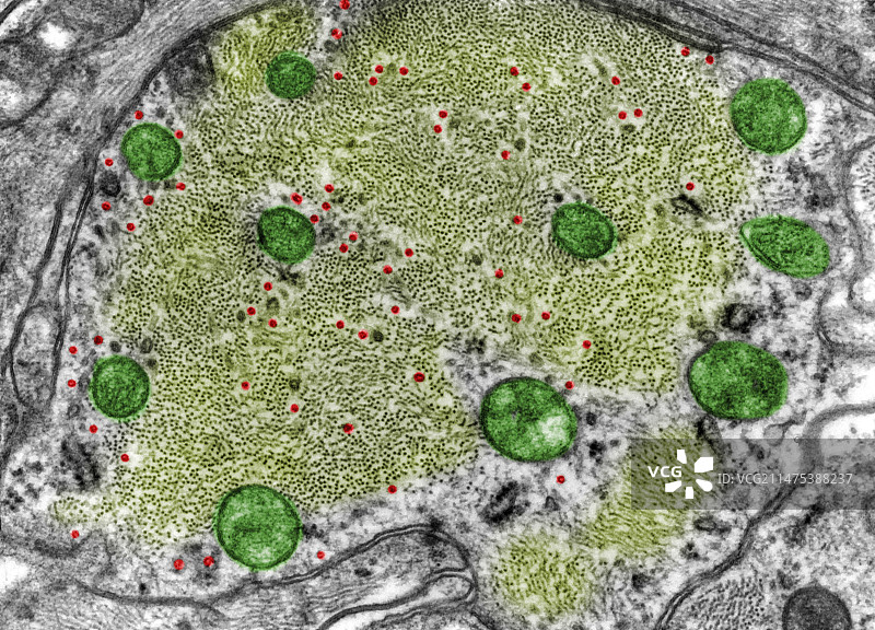 中间神经胶质丝，TEM图片素材