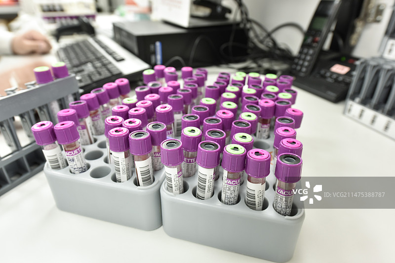 血液样本图片素材