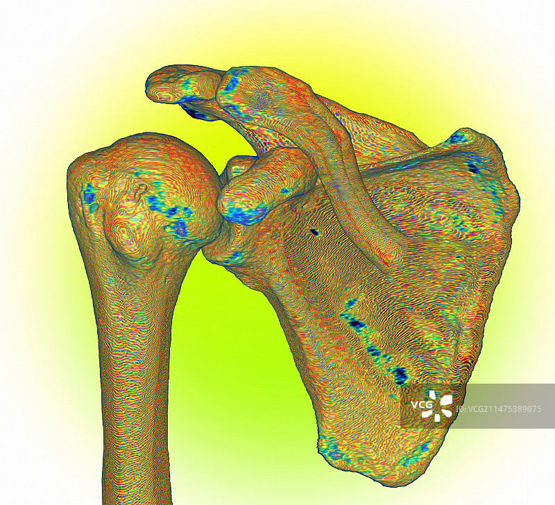 肩胛骨3D CT扫描图片素材