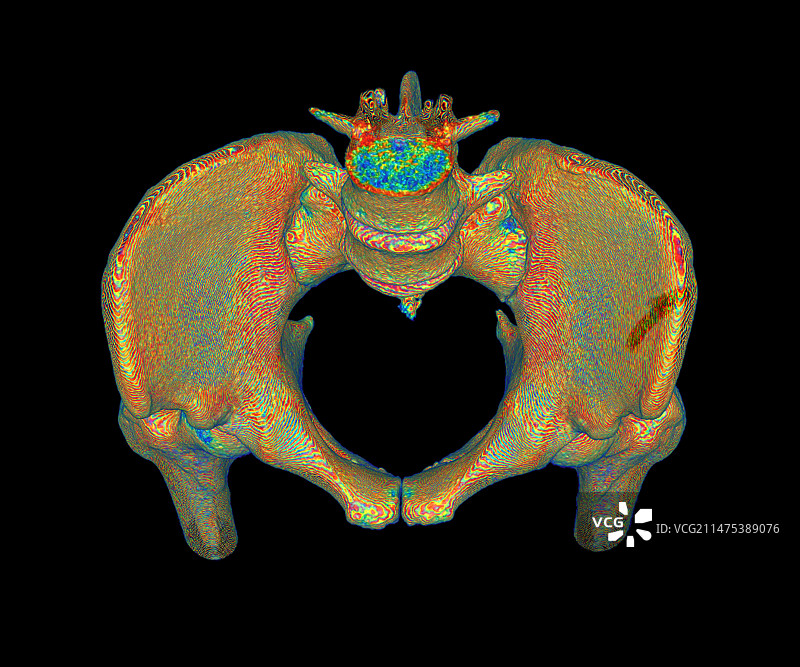 女性骨盆3D CT扫描图片素材