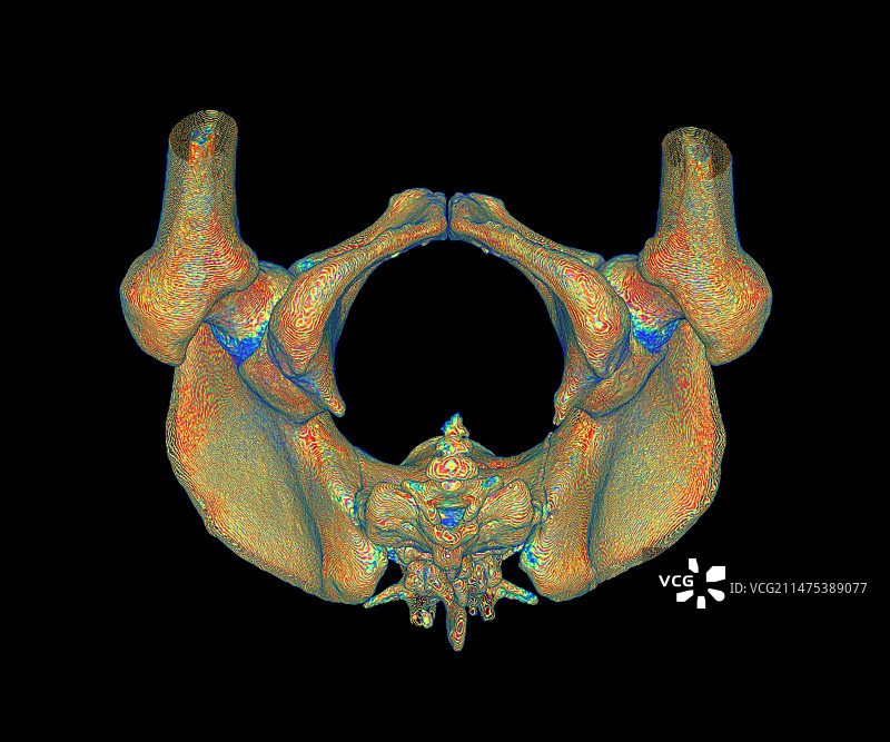 女性骨盆3D CT扫描图片素材