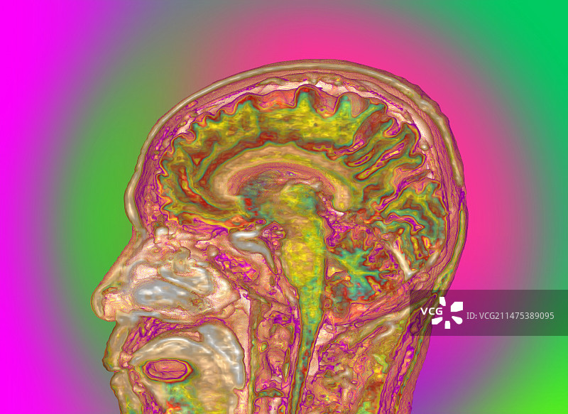 人头和大脑的3D核磁共振扫描图图片素材