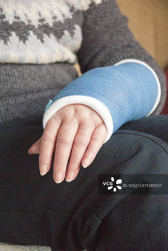 手腕Colles骨折的石膏图片素材