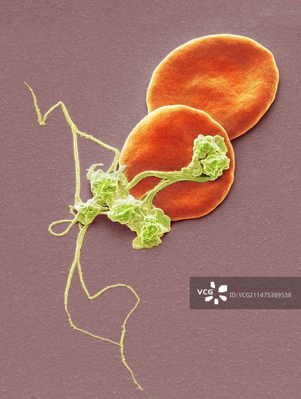 伤口部位的血液，SEM显微镜图像图片素材