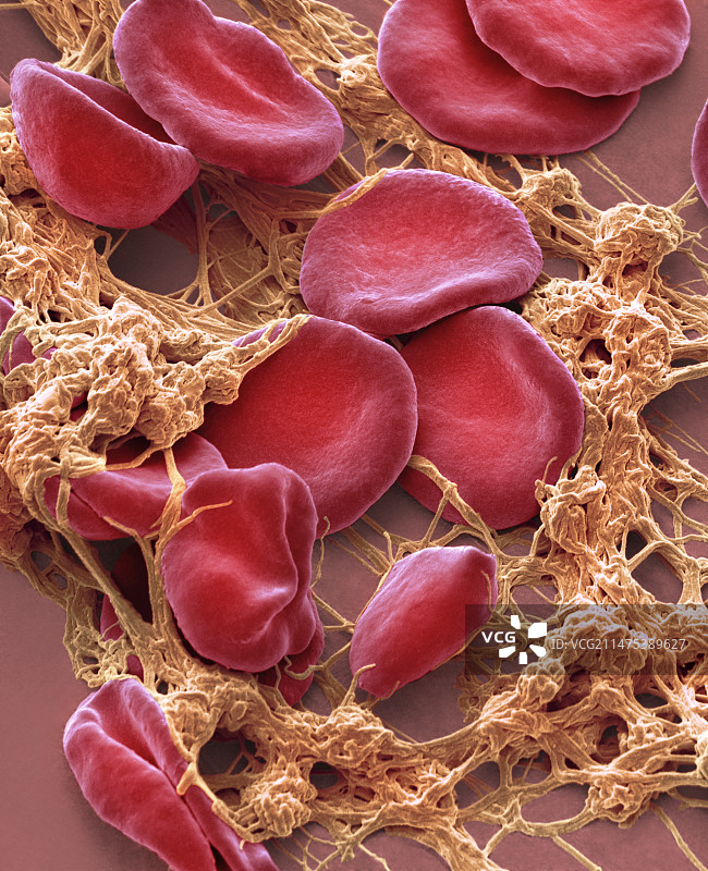 伤口部位的血液，SEM显微镜图像图片素材