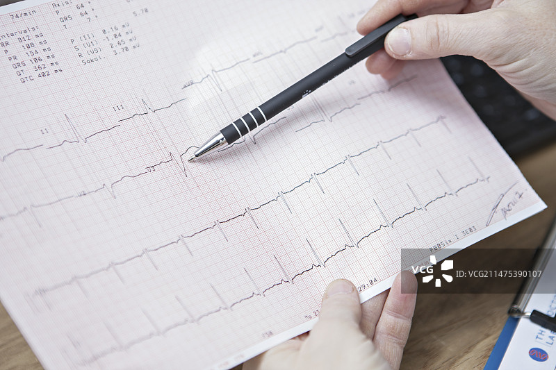 心电图测试结果图片素材