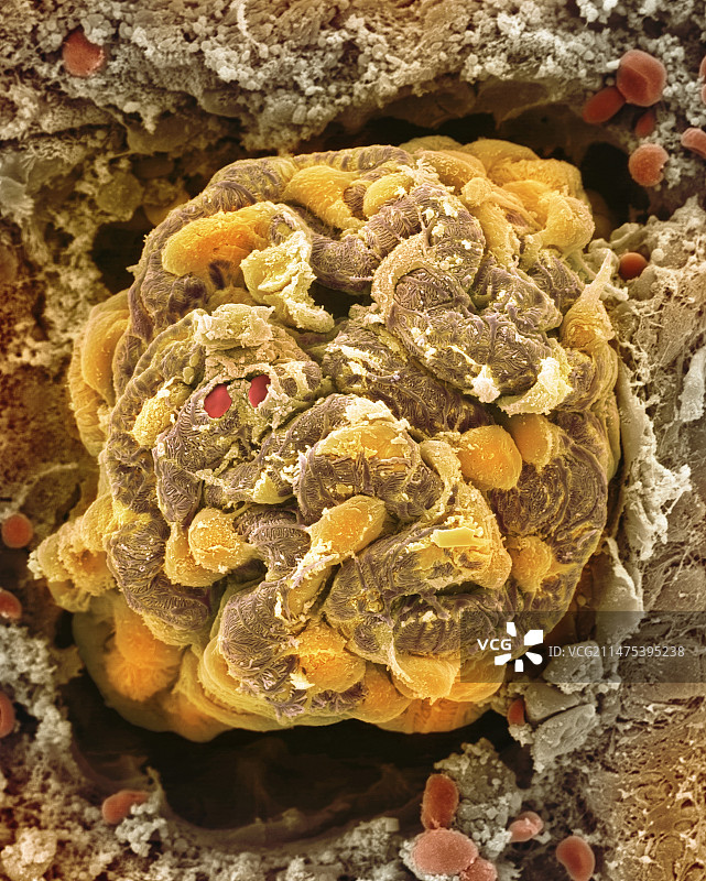 肾小球扫描电镜图图片素材