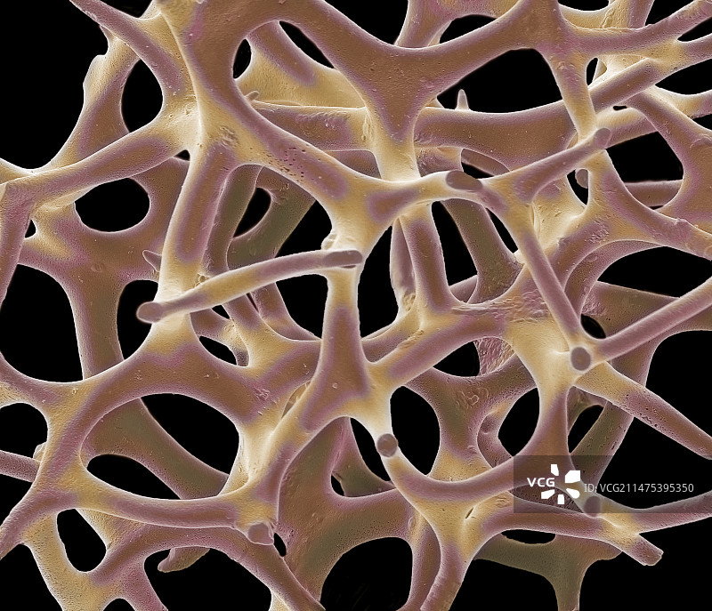 放射虫测试，扫描电镜图片素材