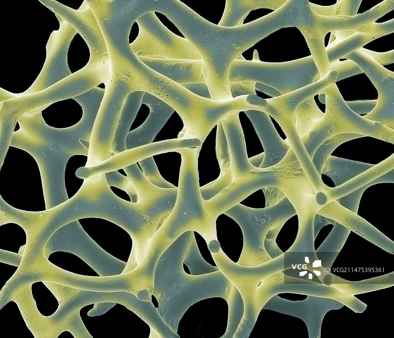 放射虫测试，扫描电镜图片素材