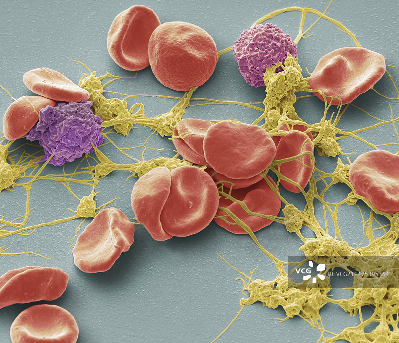 伤口部位的血液，SEM显微镜图像图片素材