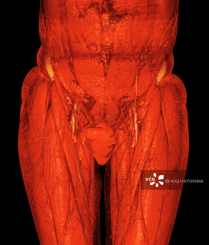 男性腹股沟解剖结构3D CT扫描图片素材