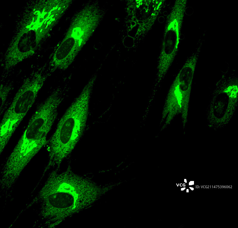 成纤维细胞荧光显微照片图片素材