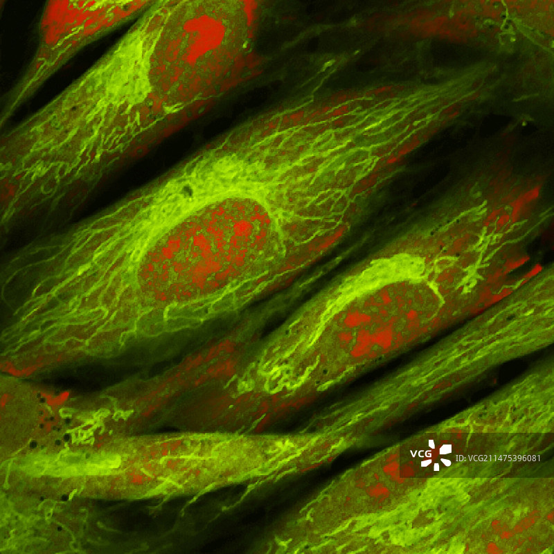 成纤维细胞荧光显微照片图片素材