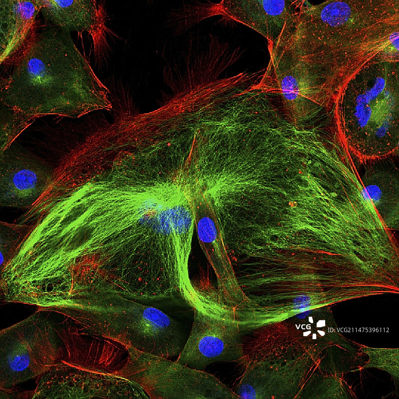 成纤维细胞荧光显微照片图片素材