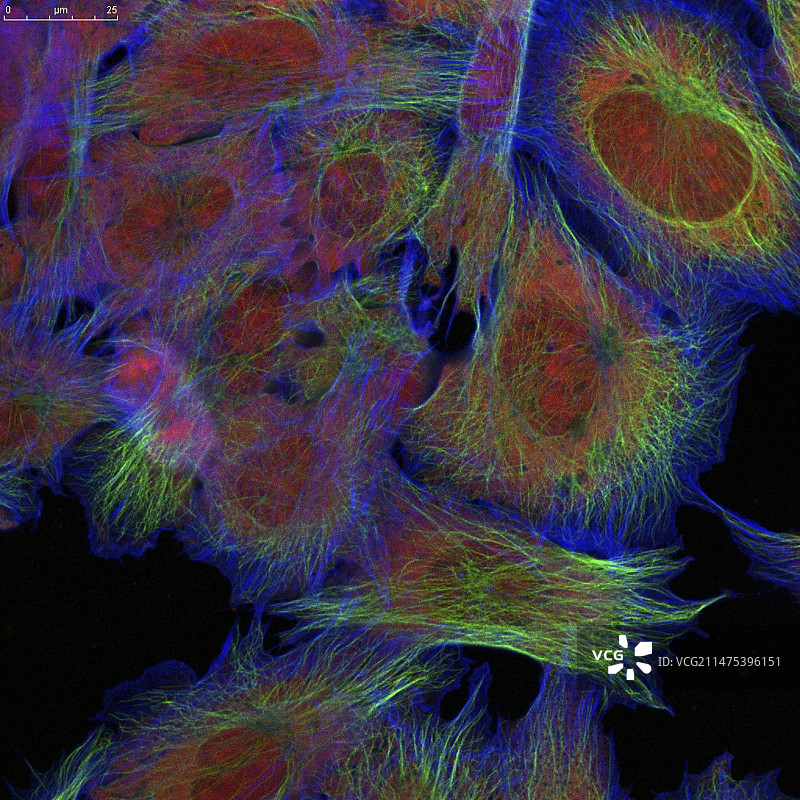 成纤维细胞荧光显微照片图片素材