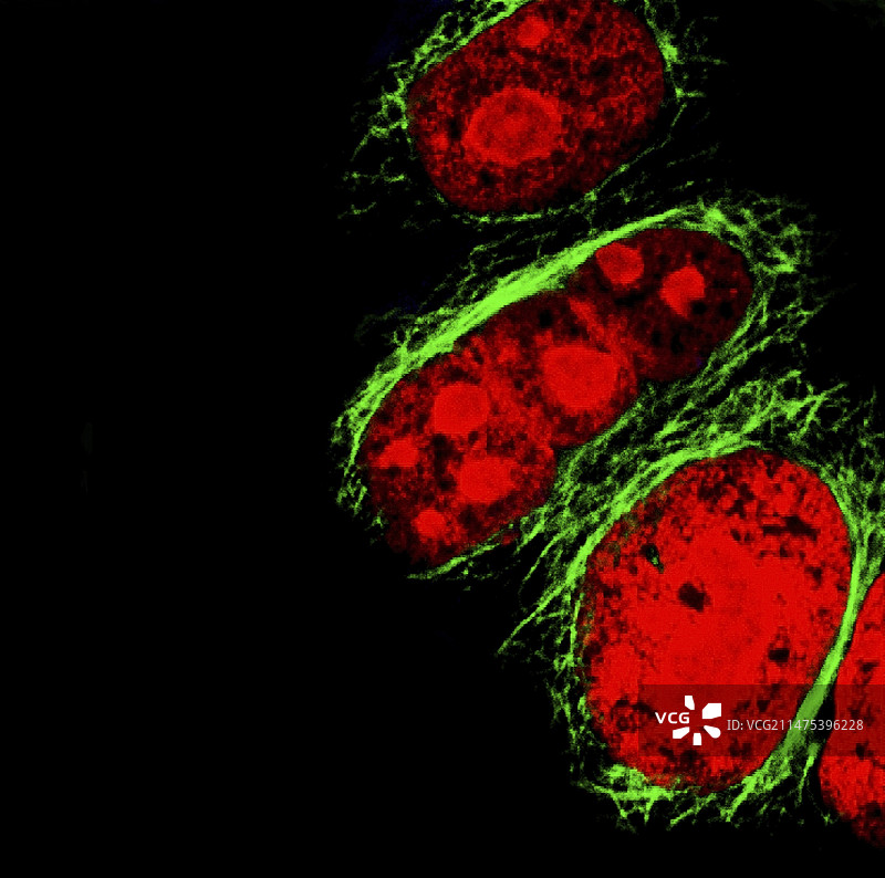 海拉宫颈癌细胞荧光显微照片图片素材