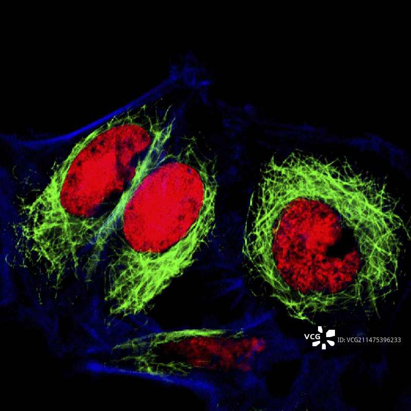 海拉宫颈癌细胞荧光显微照片图片素材