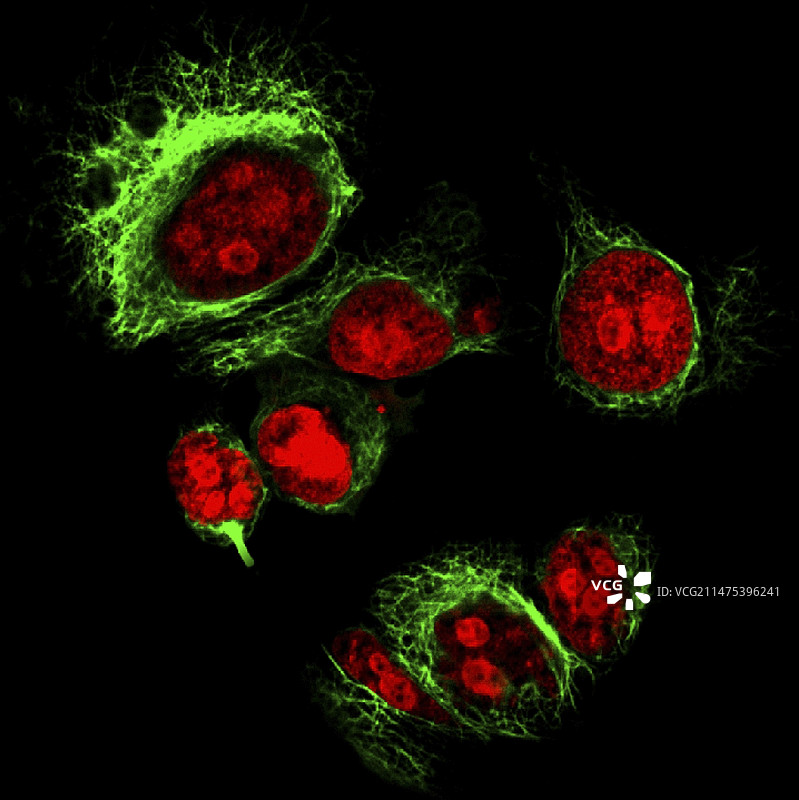 海拉宫颈癌细胞荧光显微照片图片素材