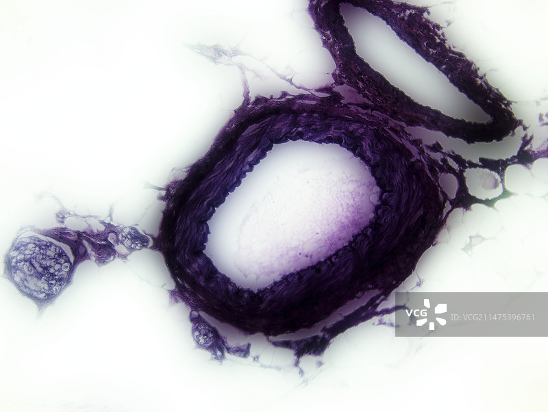 动脉横截面显微照片图片素材