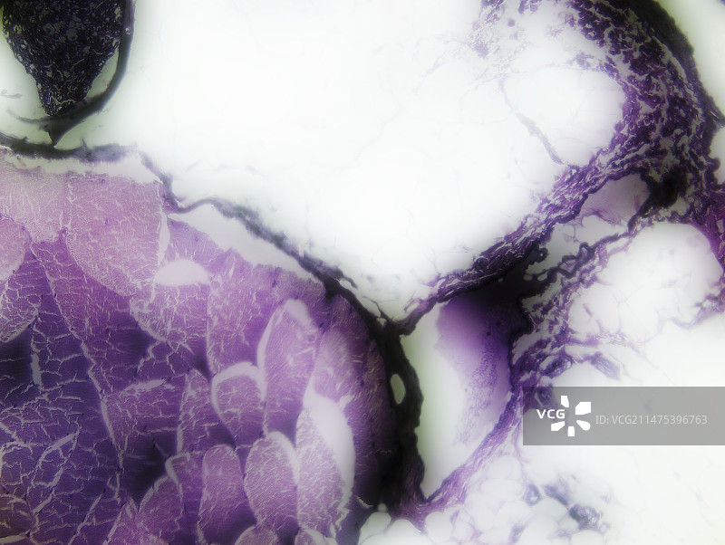 骨骼肌和神经束,光学显微照片图片素材