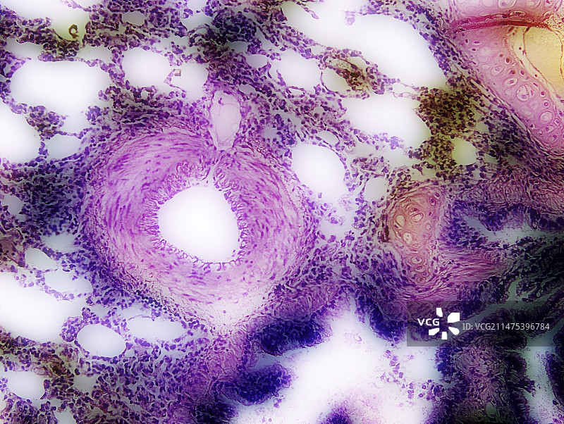 肺组织中的动脉，光学显微照片图片素材