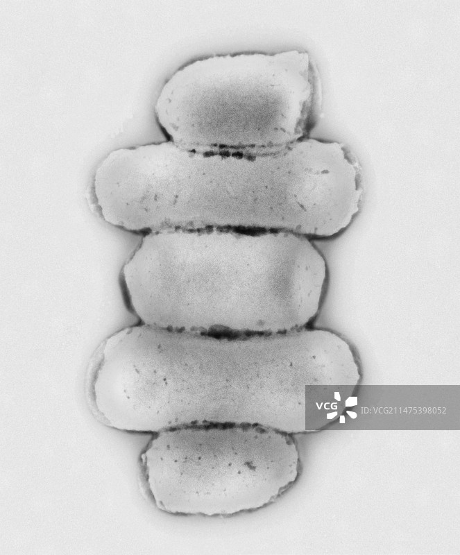 大肠杆菌（透射电镜）图片素材