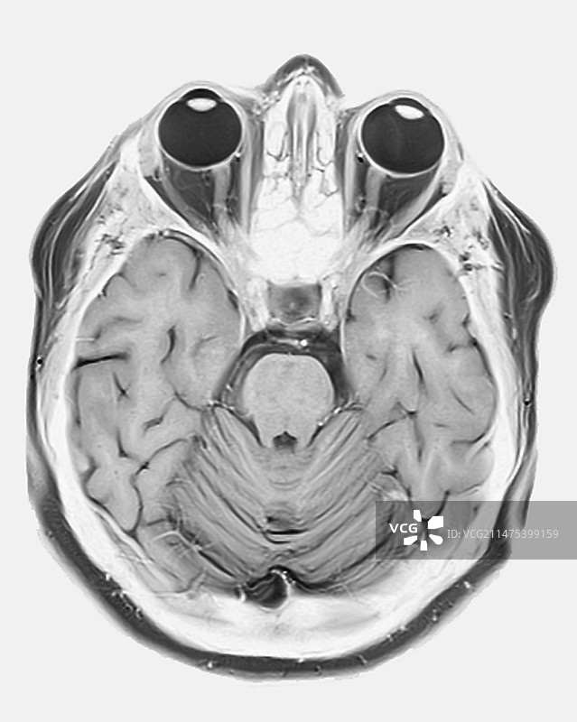 人眼和大脑的核磁共振扫描图片素材