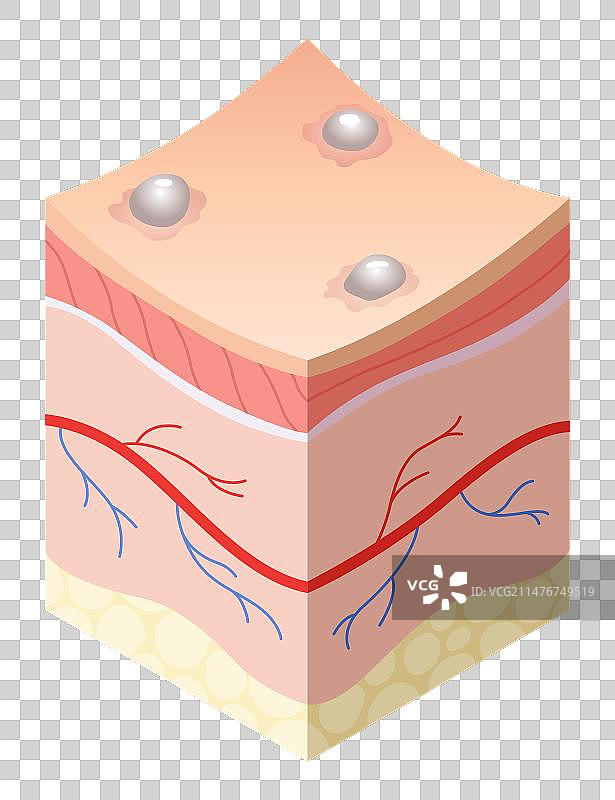 交叉的皮肤护理医学概念问题图片素材