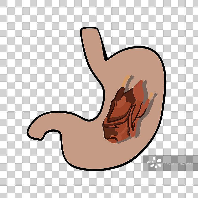 假日期间肉类消化不良图片素材