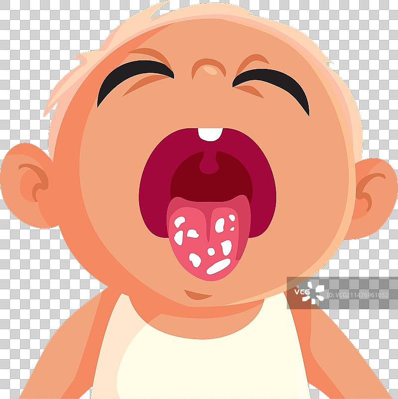 患有念珠菌病的卡通小宝宝图片素材