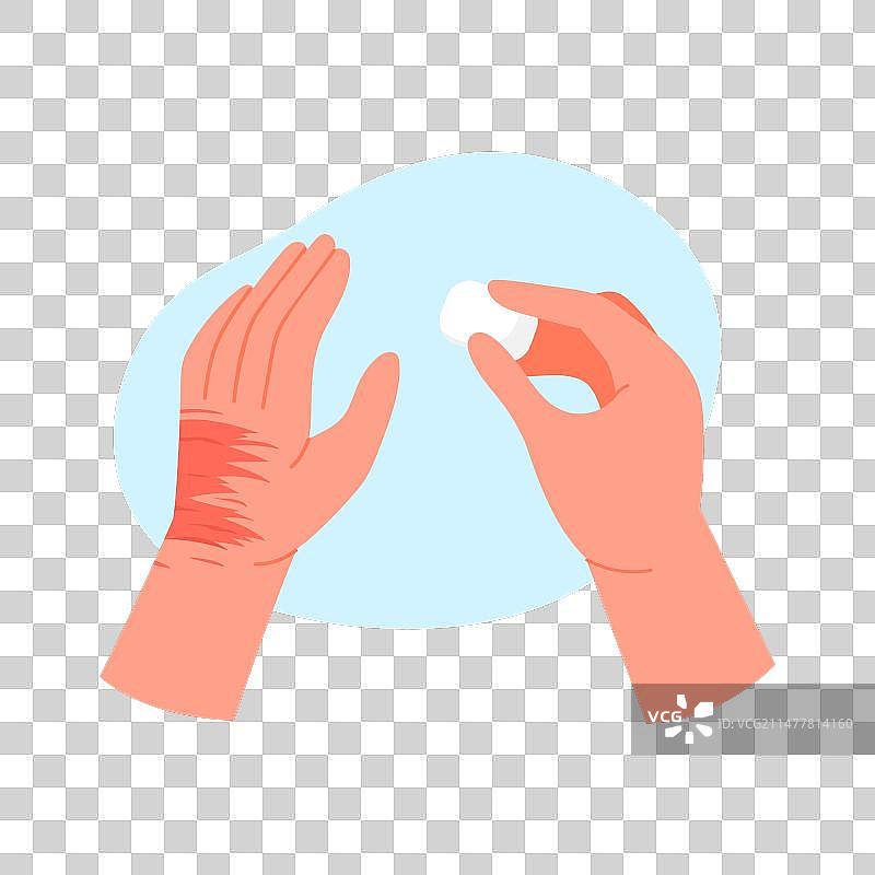 消毒人手上的伤口图片素材