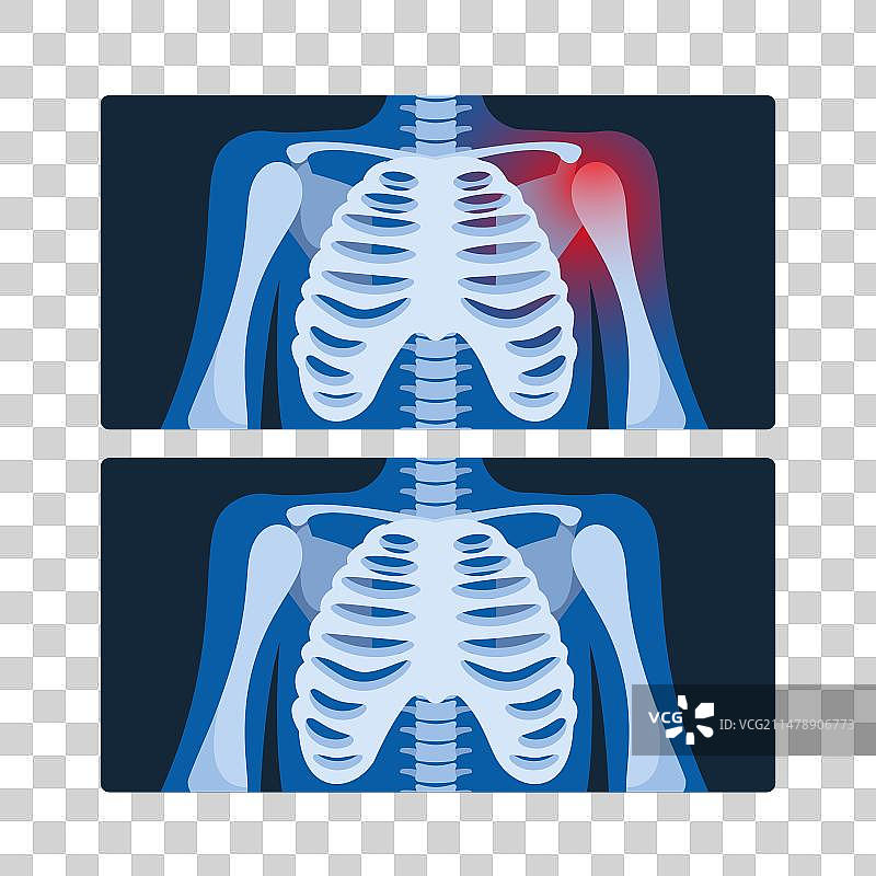 胸部X光照片图片素材