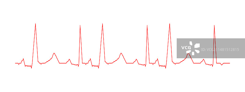 心跳图ECG图心脏节律红色图片素材