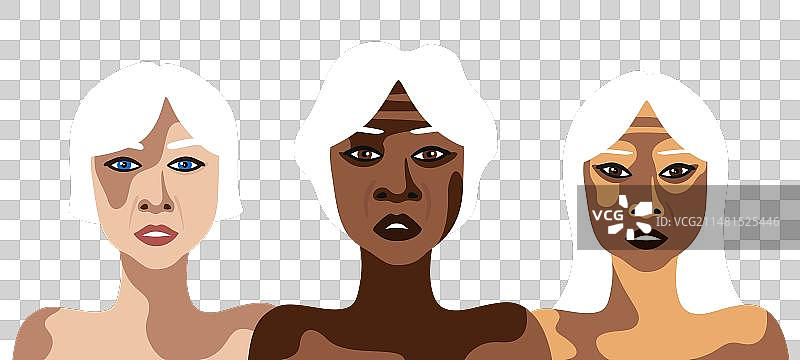 患有白化病的老年妇女概念banner图片素材