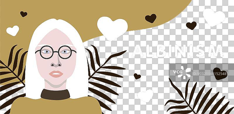 白化病主题banner，年轻女性图片素材