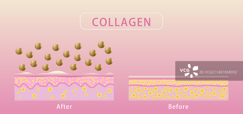 补充胶原蛋白前后效果图片素材