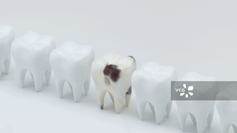 用钳子拔出坏牙图片素材