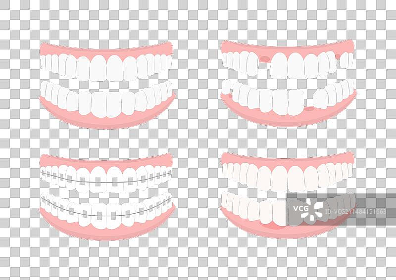牙齿套图图片素材
