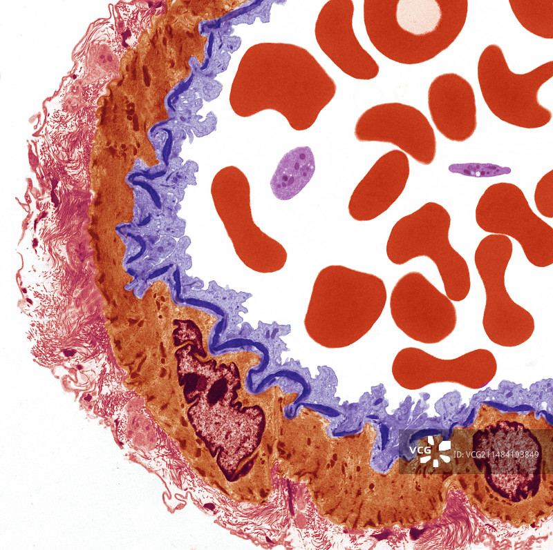 动脉，TEM图片素材