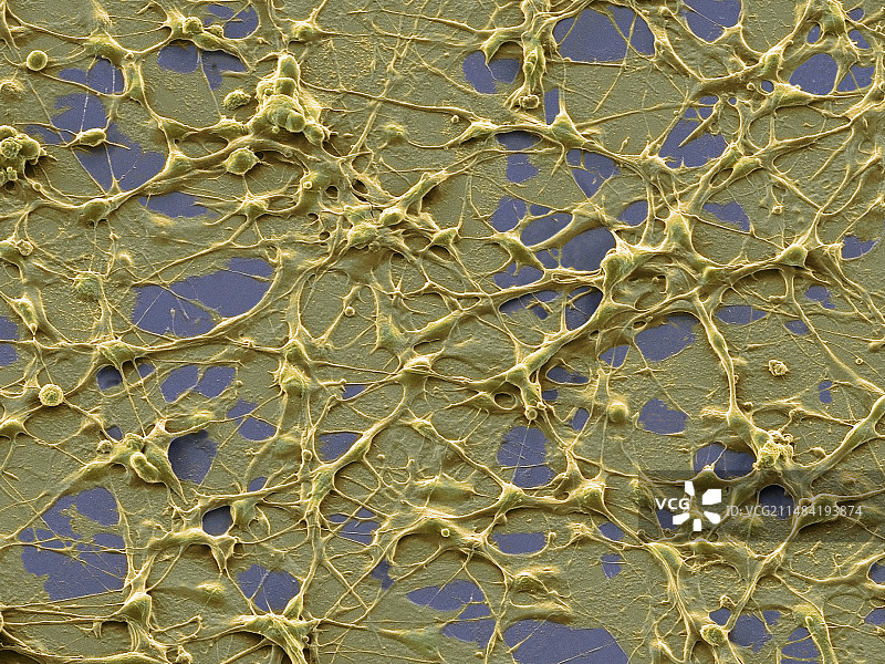 神经元扫描电镜图图片素材