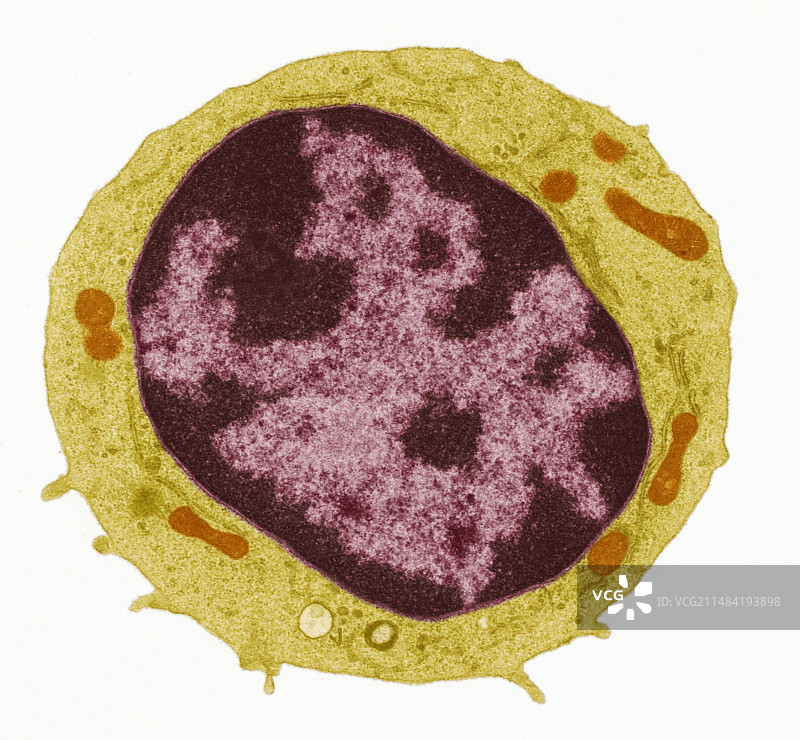 淋巴细胞，透射电镜图图片素材