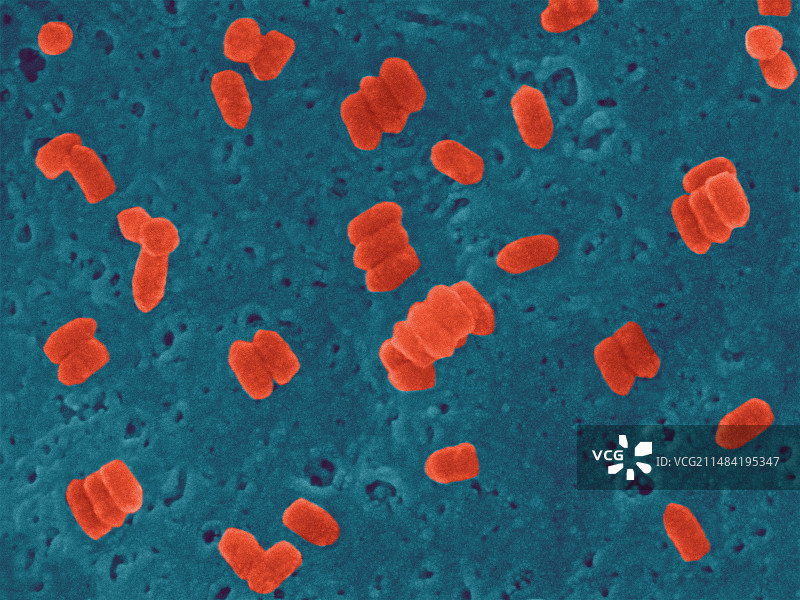 狂犬病毒扫描电镜图图片素材