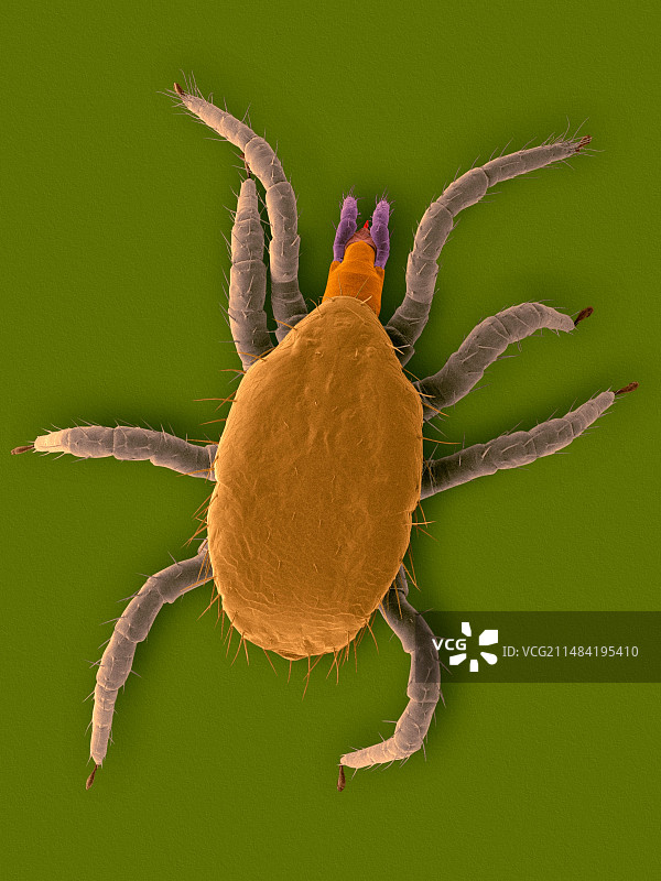 马达加斯加发声蟑螂螨虫电镜图图片素材