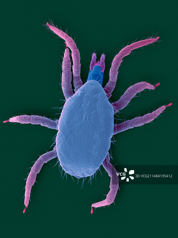 马达加斯加发声蟑螂螨虫电镜图图片素材