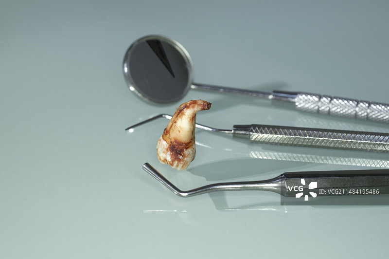 拔出的智齿图片素材