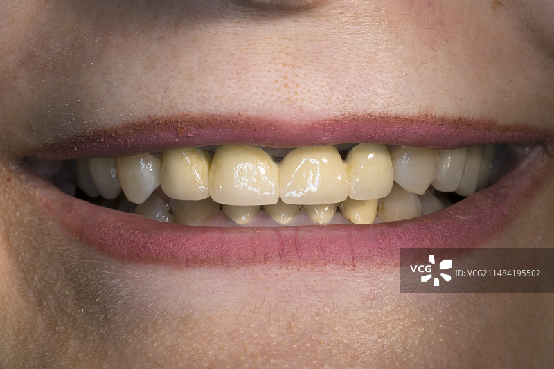 牙桥图片素材